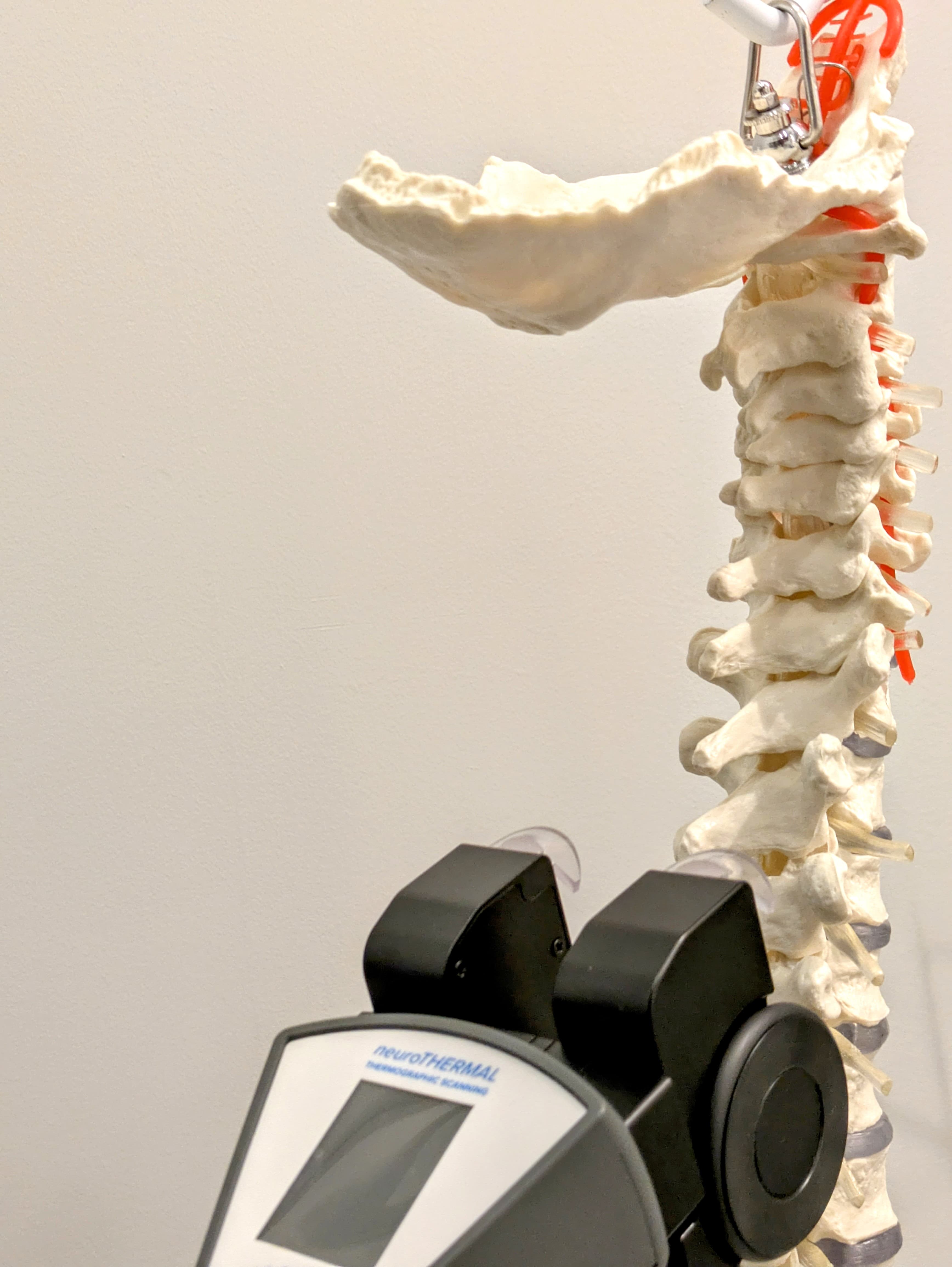 chiropractic thermography, neuroTHERMAL scan, spinal health, nerve interference, subluxations, chiropractic technology, Back2Balance